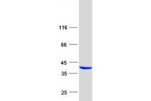 Validation with Western Blot