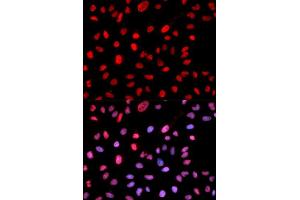 Immunofluorescence analysis of MCF7 cell using Phospho-Dnmt1-pS714 antibody. (DNMT1 antibody  (pSer714))