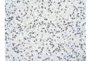Immunohistochemistry (IHC) image for anti-Transformer 2 beta Homolog (TRA2B) (N-Term) antibody (ABIN2778898)