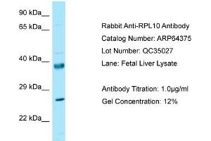 Western Blotting (WB) image for anti-Ribosomal Protein L10 (RPL10) (N-Term) antibody (ABIN2789820) (RPL10 antibody  (N-Term))