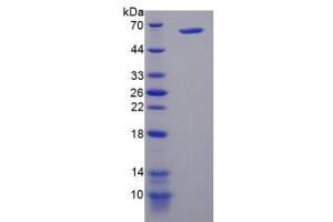 Image no. 1 for Phosphatidylinositol 4-Kinase, Catalytic, alpha (PI4KA) (AA 1-300) protein (His tag,GST tag) (ABIN4990613)