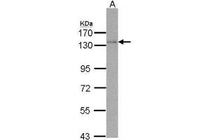 WB Image Sample (30 ug of whole cell lysate) A: Molt-4 , 7. (POLD1 antibody  (Center))