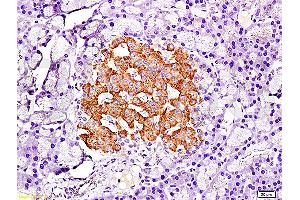 Formalin-fixed and paraffin embedded rat pancreas tissue labeled with Anti-PDX-1 Polyclonal Antibody, Unconjugated (ABIN729883) at 1:200, followed by conjugation to the secondary antibody and DAB staining (PDX1 antibody  (AA 188-284))