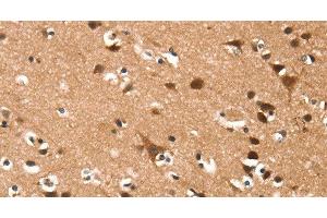 Immunohistochemistry of paraffin-embedded Human brain using DAAM1 Polyclonal Antibody at dilution of 1:50 (DAAM1 antibody)