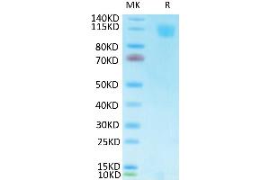 Biotinylated SARS Spike S1 on Tris-Bis PAGE under reduced condition. (SARS-CoV-2 Spike S1 Protein (His-Avi Tag,Biotin))