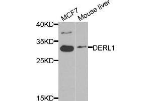 Western blot analysis of extracts of MCF7 and mouse liver cells, using DERL1 antibody. (DERL1 antibody)