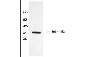 Antigen: Colo 205 cells lysate (Total protein per lane: 20 µg)  Primary Antibody: Anti-EFNB2 monoclonal (PA349-18. (Ephrin B2 antibody  (Extracellular Domain))