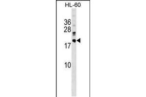 Western blot analysis in HL-60 cell line lysates (35ug/lane). (DNAJC30 antibody  (C-Term))
