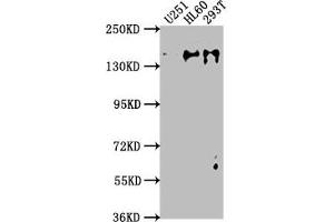 Western Blot Positive WB detected in: U251 whole cell lysate, HL60 whole cell lysate, 293T whole cell lysate All lanes: ADNP antibody at 1:2000 Secondary Goat polyclonal to rabbit IgG at 1/50000 dilution Predicted band size: 124 kDa Observed band size: 135 kDa (ADNP antibody  (AA 867-1102))