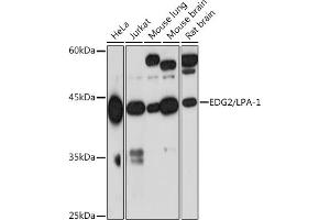 Western blot analysis of extracts of various cell lines, using EDG2/LPA-1 Rabbit mAb (ABIN7268334) at 1:1000 dilution. (LPAR1 antibody)
