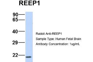 Host:  Rabbit  Target Name:  REEP1  Sample Type:  Human Fetal Brain  Antibody Dilution:  1. (Receptor Accessory Protein 1 antibody  (C-Term))