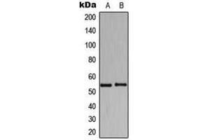 Western blot analysis of HARS expression in K562 (A), Raw264. (HARS1/Jo-1 antibody  (C-Term))