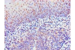 Immunohistochemistry of paraffin-embedded human tonsil tissue using ABIN7167479 at dilution of 1:100 (RIPK3 antibody  (AA 1-120))