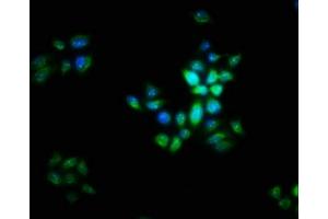 Immunofluorescence staining of PC-3 cells with ABIN7165742 at 1:16, counter-stained with DAPI. (LIX1 antibody  (AA 1-282))