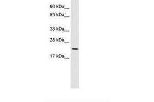 Image no. 2 for anti-Protein L-Myc (MYCL) (AA 135-184) antibody (ABIN202065) (LMYC antibody  (AA 135-184))