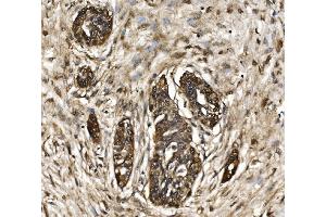 IHC analysis of Proteasome 20S Beta 7/PSMB7 using anti-Proteasome 20S Beta 7/PSMB7 antibody (ABIN7600256).