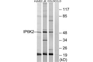 Western Blotting (WB) image for anti-Inositol Hexakisphosphate Kinase 2 (IP6K2) (Internal Region) antibody (ABIN1850058) (IP6K2 antibody  (Internal Region))