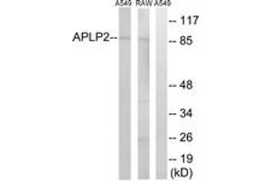 Western blot analysis of extracts from RAW264. (APLP2 antibody  (AA 241-290))