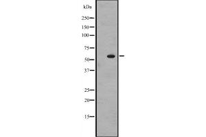 Western blot analysis of ZNF71 expression in A431 whole cell lysate ,The lane on the left is treated with the antigen-specific peptide.
