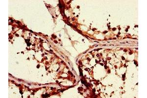 Immunohistochemistry of paraffin-embedded human testis tissue using ABIN7155852 at dilution of 1:100 (TGIF1 antibody  (AA 8-375))