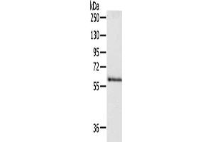 Gel: 8 % SDS-PAGE, Lysate: 40 μg, Lane: Human fetal brain tissue, Primary antibody: ABIN7190498(DPYSL5 Antibody) at dilution 1/250, Secondary antibody: Goat anti rabbit IgG at 1/8000 dilution, Exposure time: 30 seconds (DPYSL5 antibody)