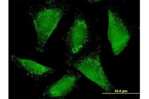 Immunofluorescence of purified MaxPab antibody to ACAA1 on HepG2 cell. (ACAA1 antibody  (AA 1-424))