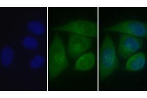 Detection of CALR in Human MCF7 cell using Polyclonal Antibody to Calreticulin (CALR) (Calreticulin antibody  (AA 18-193))