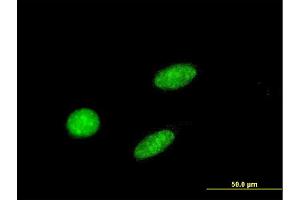 Immunofluorescence of monoclonal antibody to GCM1 on HeLa cell. (GCM1 antibody  (AA 108-166))