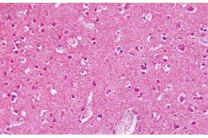 GRM2 antibody  (N-Term)