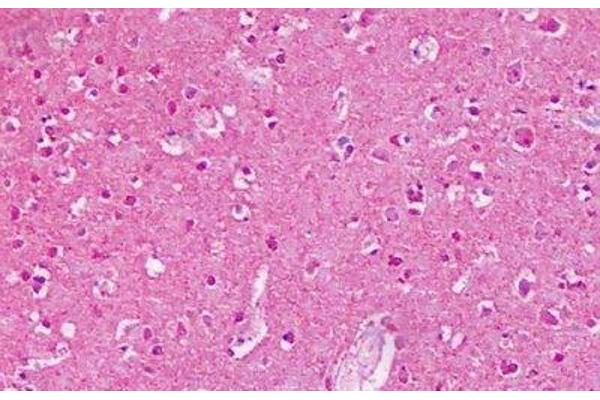 GRM2 antibody  (N-Term)