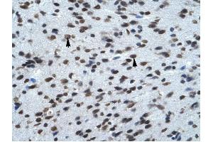 KCNK13 antibody was used for immunohistochemistry at a concentration of 4-8 ug/ml to stain Neural cells (arrows) in Human Brain. (KCNK13 antibody  (C-Term))