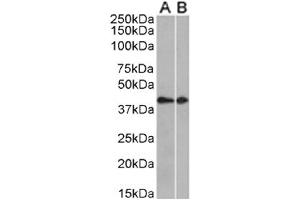 Western Blot using anti-CCRL2 antibody. (Recombinant CCRL2 antibody  (AA 1-24))