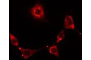ABIN6278631 staining Hela cells by IF/ICC.