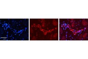 Rabbit Anti-PHF1 Antibody   Formalin Fixed Paraffin Embedded Tissue: Human heart Tissue Observed Staining: Cytoplasmic in endothelial cells in blood vessels Primary Antibody Concentration: 1:100 Other Working Concentrations: 1:600 Secondary Antibody: Donkey anti-Rabbit-Cy3 Secondary Antibody Concentration: 1:200 Magnification: 20X Exposure Time: 0. (PHF1 antibody  (C-Term))