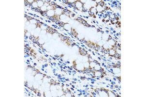 Immunohistochemistry of paraffin-embedded human colon using GIP antibody (ABIN5973668) at dilution of 1/100 (40x lens). (GIP antibody)