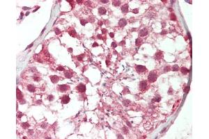 Human Testis: Formalin-Fixed, Paraffin-Embedded (FFPE). (POU3F1 antibody  (AA 361-410))