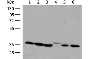 Western blot analysis of 293T and A375 cell lysates using LDHA Polyclonal Antibody at dilution of 1:250 (Lactate Dehydrogenase A antibody)