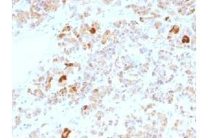 IHC testing of FFPE human pituitary gland stained with Luteinizing Hormone alpha antibody (clone LHa/756). (LH alpha antibody)