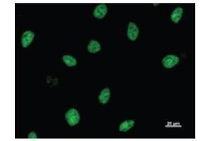 Immunostaining analysis in HeLa cells. (ASH2L antibody)