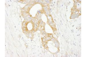 Immunohistochemistry (IHC) image for anti-Eukaryotic Translation Initiation Factor 3 Subunit J (EIF3S1) (AA 208-258) antibody (ABIN7448547)