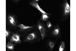 Immunofluorescent staining of A549 (ATCC CCL-185) cells. (PIK3CA antibody  (AA 562-724))
