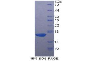 SDS-PAGE (SDS) image for Killer Cell Lectin-Like Receptor Subfamily B, Member 1 (KLRB1) (AA 73-188) protein (His tag,T7 tag) (ABIN1879590)