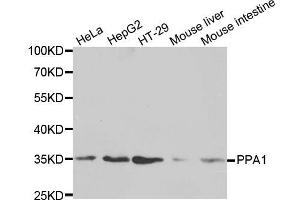 Western blot analysis of extracts of various cell lines, using PPA1 antibody (ABIN5971134) at 1/1000 dilution. (Pyrophosphatase (Inorganic) 1 (PPA1) antibody)