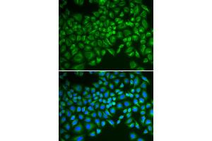 Immunofluorescence analysis of MCF-7 cells using SELE antibody. (Selectin E/CD62e antibody)