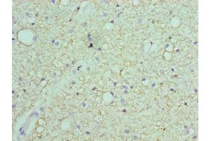 Immunohistochemistry of paraffin-embedded human brain tissue using ABIN7168870 at dilution of 1:100 (Septin 7 antibody  (AA 308-437))