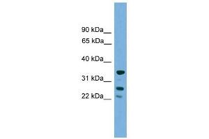 H1FOO antibody used at 1 ug/ml to detect target protein. (H1FOO antibody  (Middle Region))