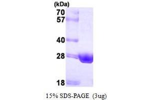 HSD17B10 Protein (AA 12-261) (His tag)