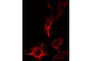 ABIN6275356 staining HepG2 cells by IF/ICC. (PITPNB antibody  (C-Term))