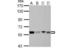 WB Image Sample (30 ug of whole cell lysate) A: 293T B: A431 C: HeLa D: HepG2 7. (PTBP1 antibody)