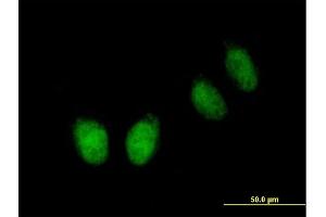 Immunofluorescence of purified MaxPab antibody to NUB1 on HeLa cell. (NUB1 antibody  (AA 1-601))